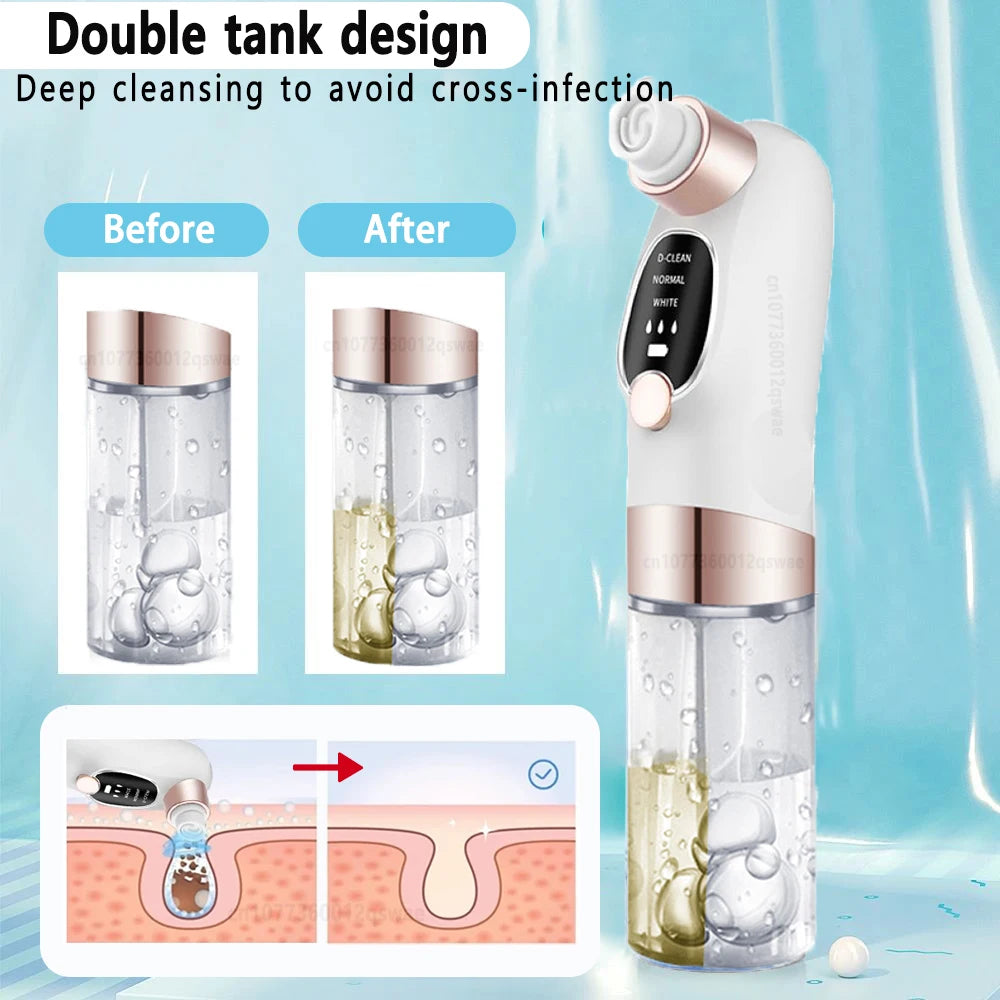 Pore Vacuum Cleaner Blackhead Remover